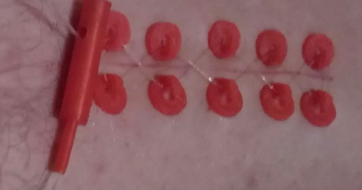 How wound sew without a needle? Indiegogo