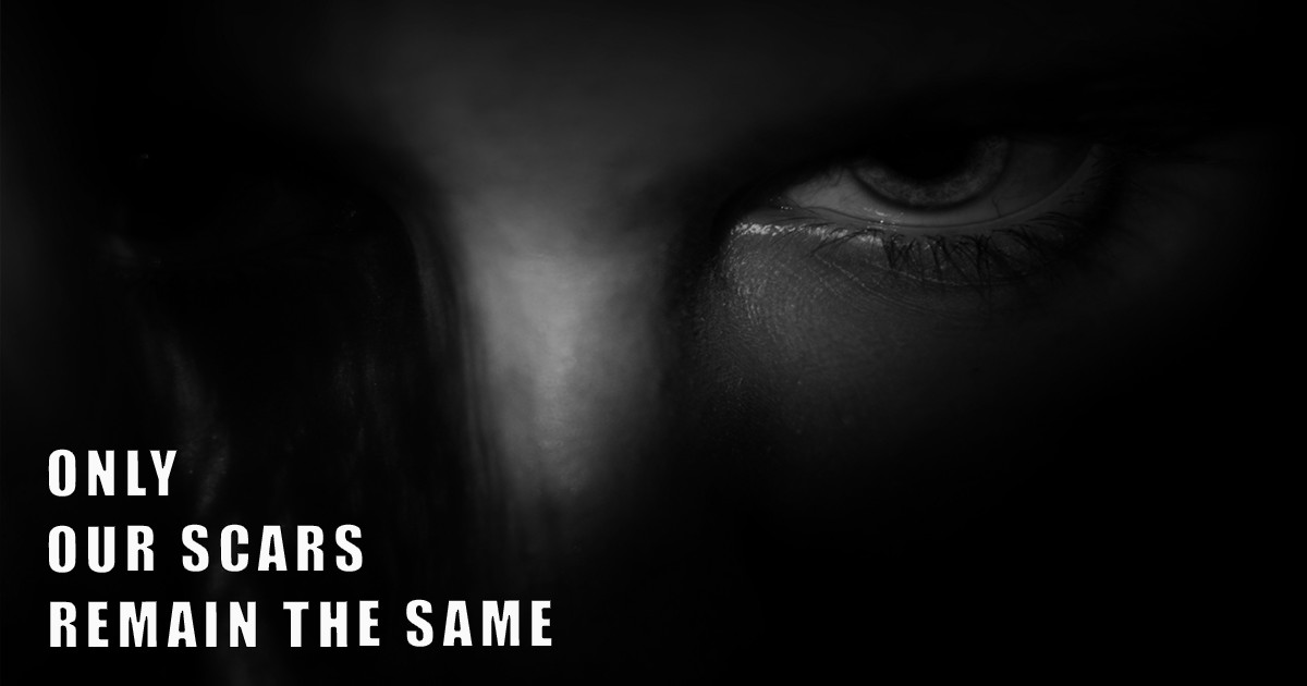 Only Our Scars Remain The Same | Indiegogo