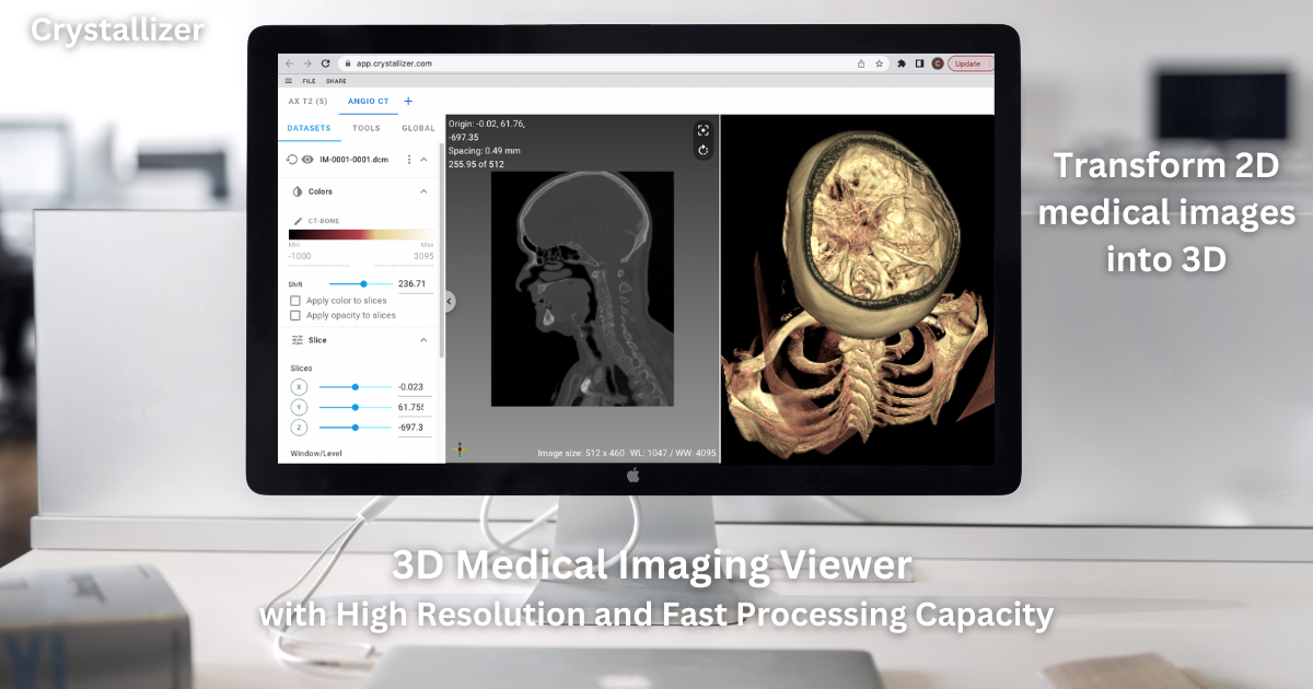 3D Medical Imaging Viewer for Accurate Diagnoses Indiegogo