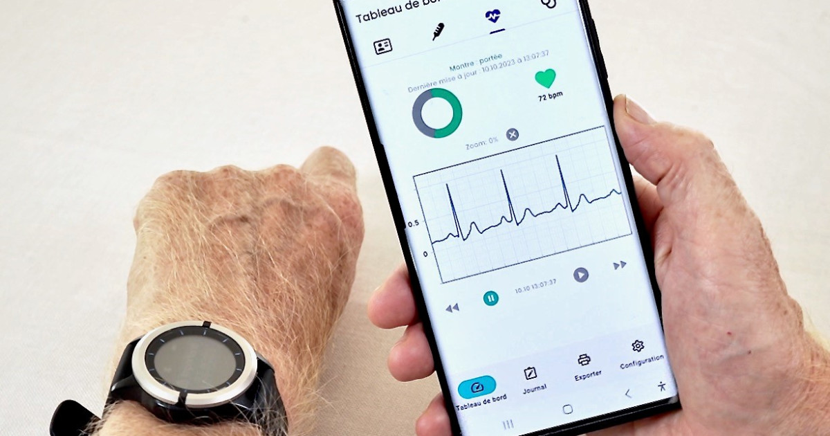 DTECTIO Wearable ECG Monitor - AI-Empowered