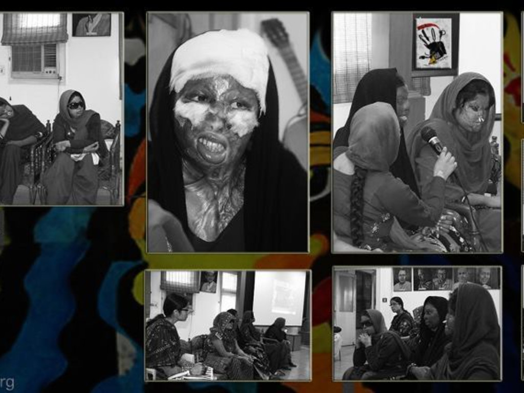 Stop Acid Attacks campaign needs immediate action funding Indiegogo