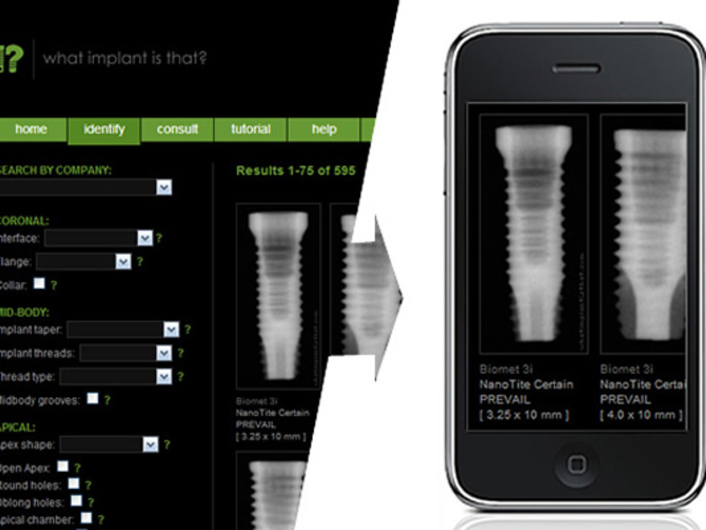 First Dental Implant Identification Mobile APP Indiegogo