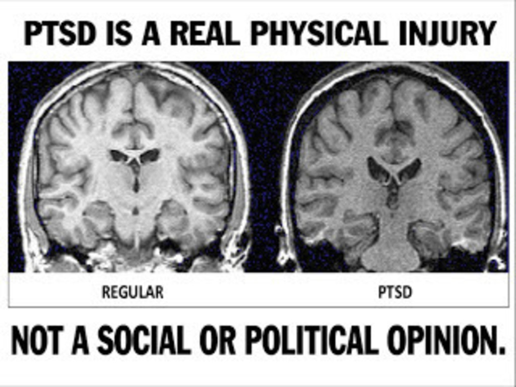 Ptsd Veterans And The Purple Heart Indiegogo Ptsd Veterans And The Purple Heart Indiegogo