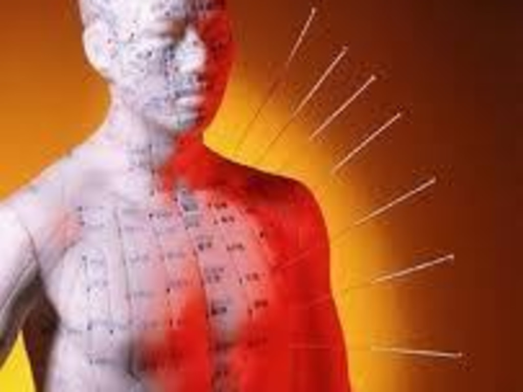 Keep Affordable Acupuncture Alive! Indiegogo