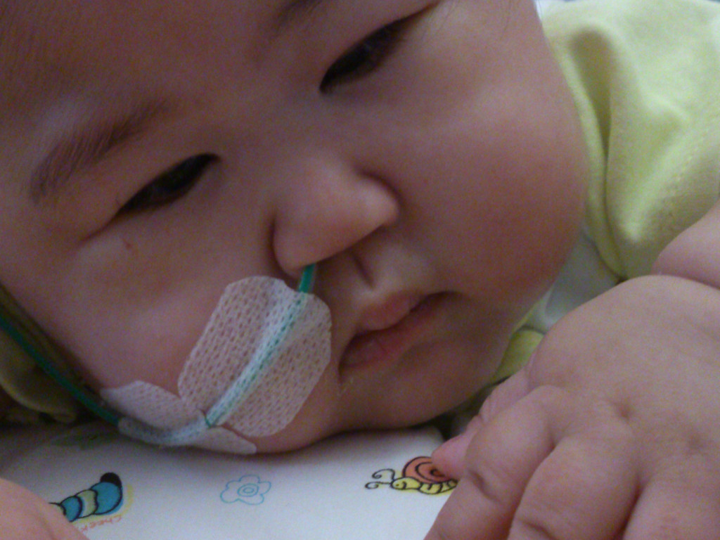 Save Baby Yujia - Help her eat by her mouth | Indiegogo