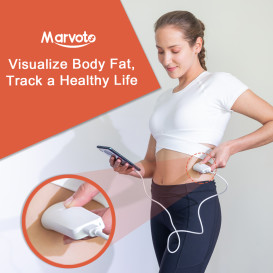 Marvoto Z1 Ultrasound Body Fat Scanner