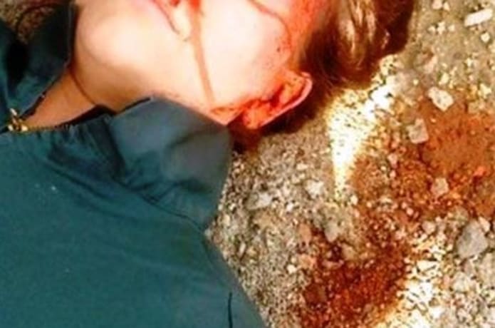 Head wound.