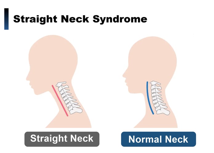 straight neck