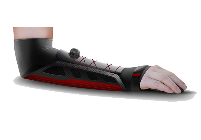Flashe Glove Improve Performance Reduce Strain Indiegogo