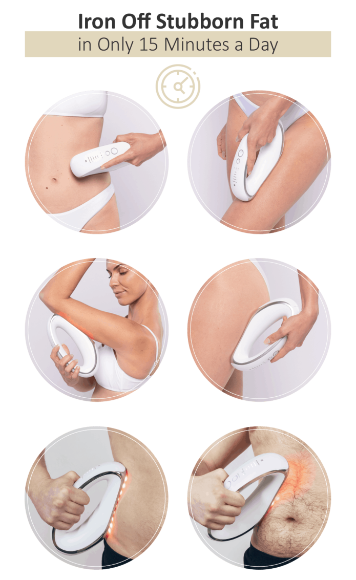 Fat Iron Pro-Iron off stubborn fat & stretch marks | Indiegogo