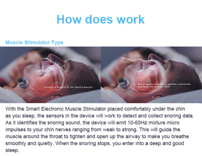 Snore Circle Snore Earset E4 Anti Snoring Device Indiegogo