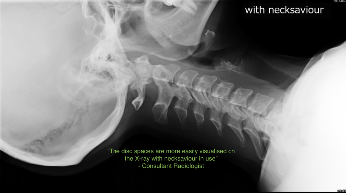 X-ray of a neck, with necksaviour