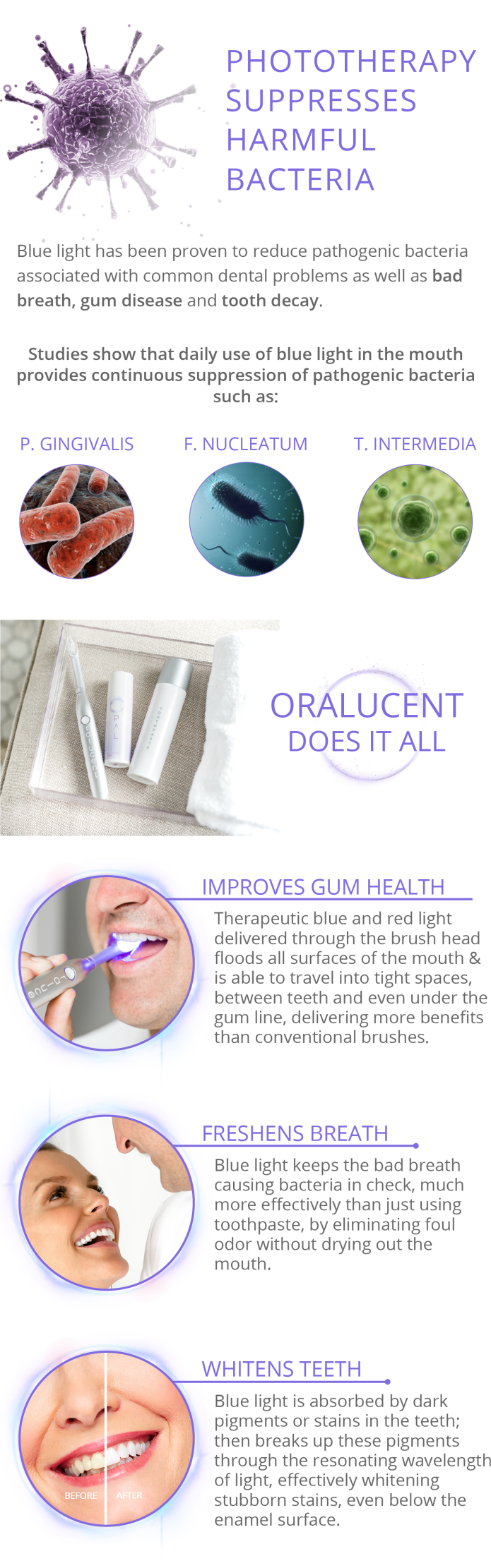 oralucent toothbrush price